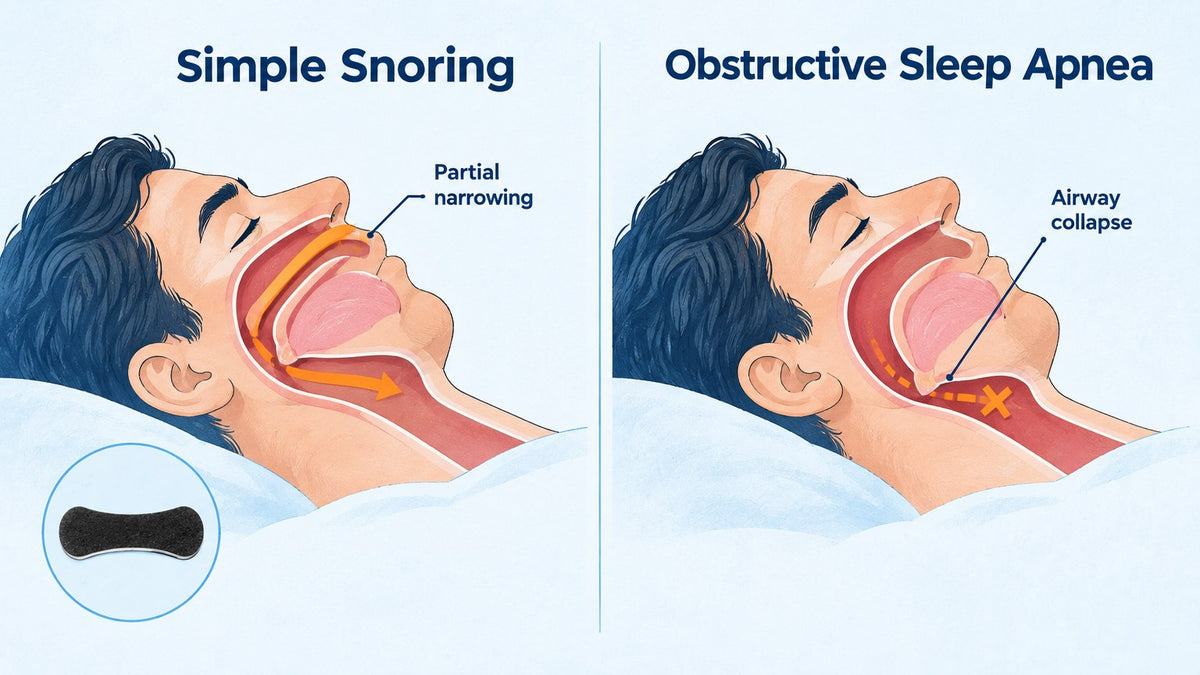 snoring vs sleep apnea airway diagram showing difference in airflow